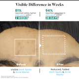 Bio Code Tranexamic Acid & Vitamin C Serum